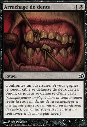 Arrachage de dents